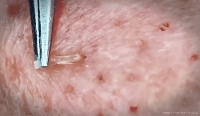 MEDICUBE - Toner Pad (Crayon Shin-chan Edition)