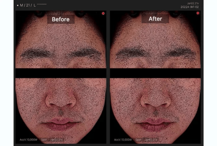 MEDICUBE - Toner Pad (Crayon Shin-chan Edition)