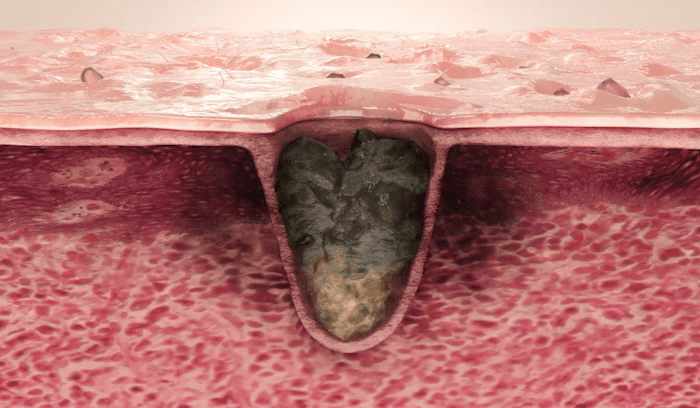 MEDICUBE - Toner Pad (Crayon Shin-chan Edition)