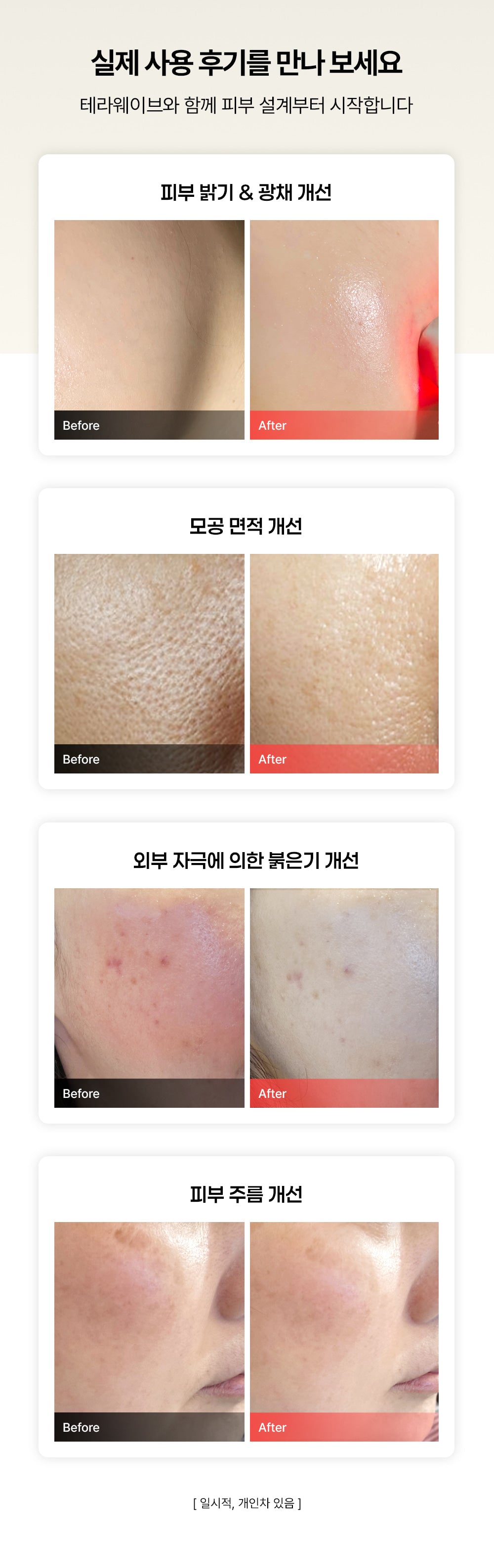 THERAWAVE - Beauty Device (Classic Gift Pack)