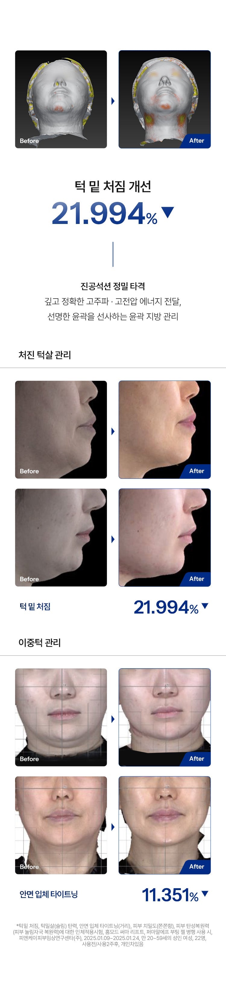 HOMEMODE - Therma Lift Beauty Device (+3 Skin Booster Ampoules)
