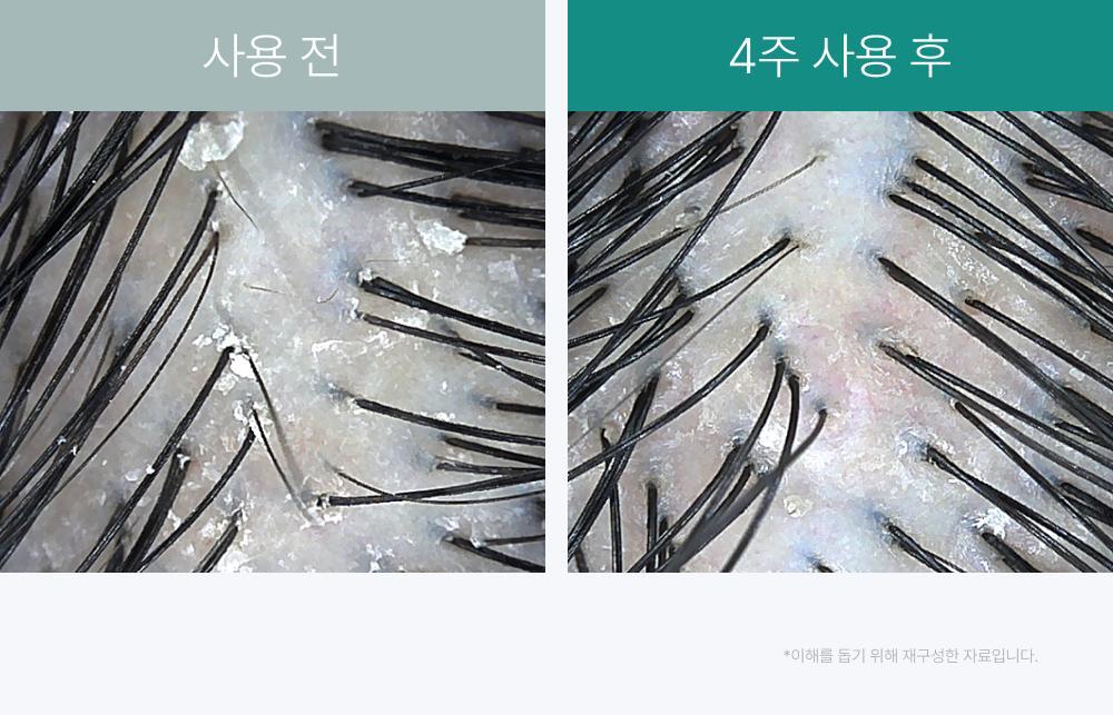 lilyeve - Scalp Turn Cica PDRN Brush Ampoule 100ml + 30ml + Jigglypuff Brush (Pokémon Collaboration)