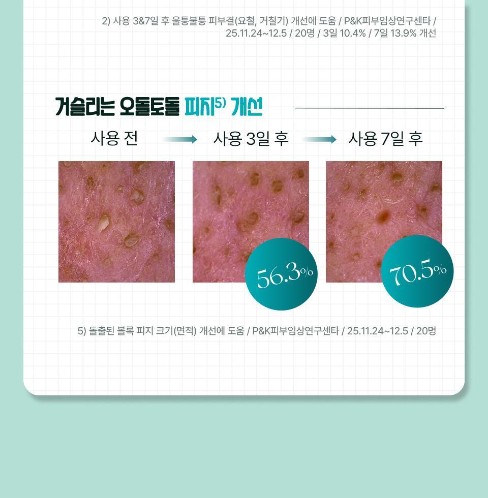 ISOI - Brightening Calming Spot Serum 35ml + Refill 35ml (KYEHOON Pick)