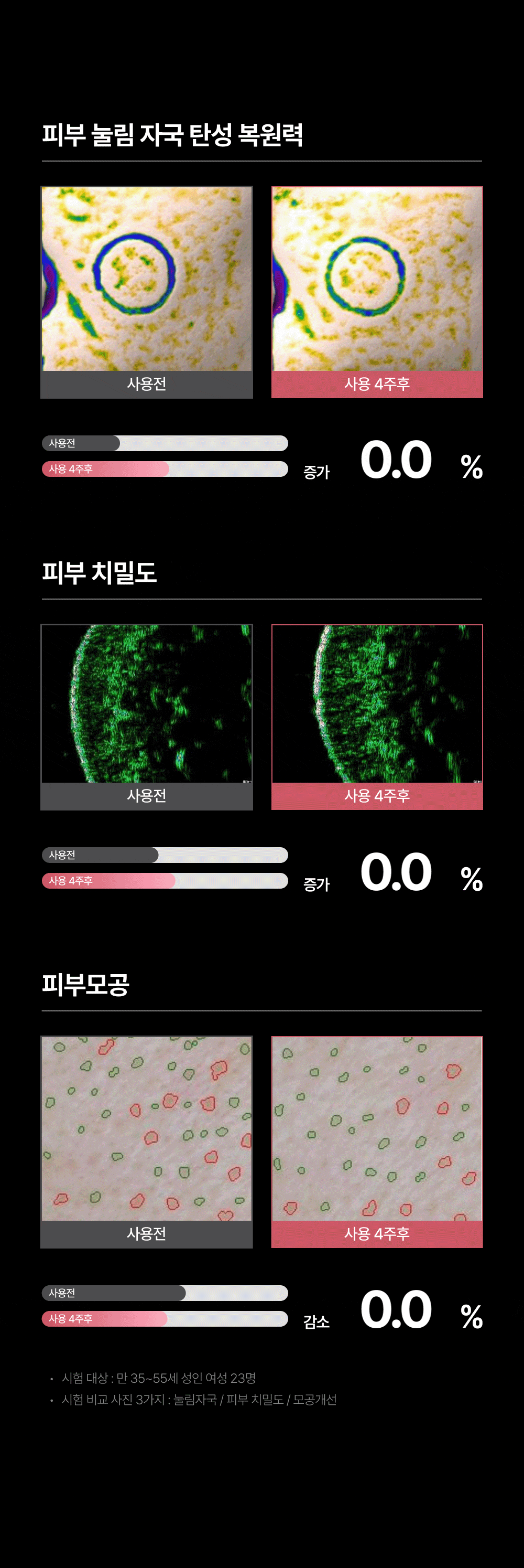HOMETHERA - Home HIFU Lifting Device (100,000 Shots)
