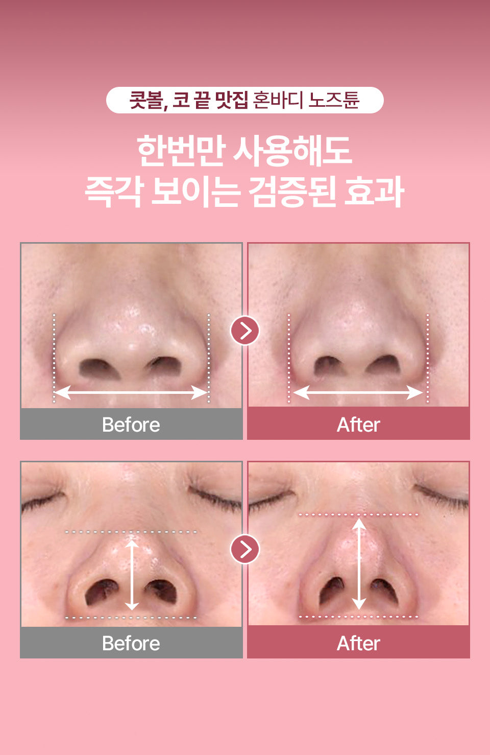 HONBODY - Nose Tune (Beauty Device)