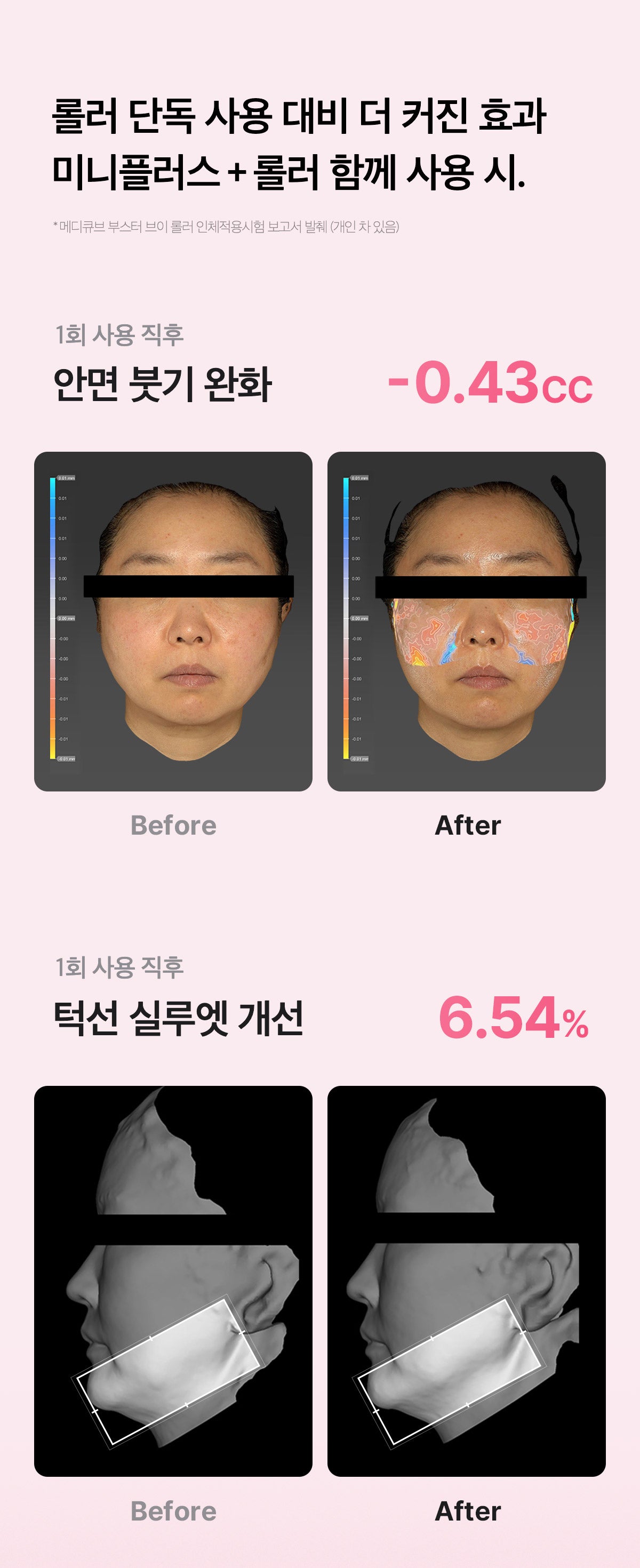 MEDICUBE AGE-R BOOSTER V ROLLER (BEAUTY DEVICE)