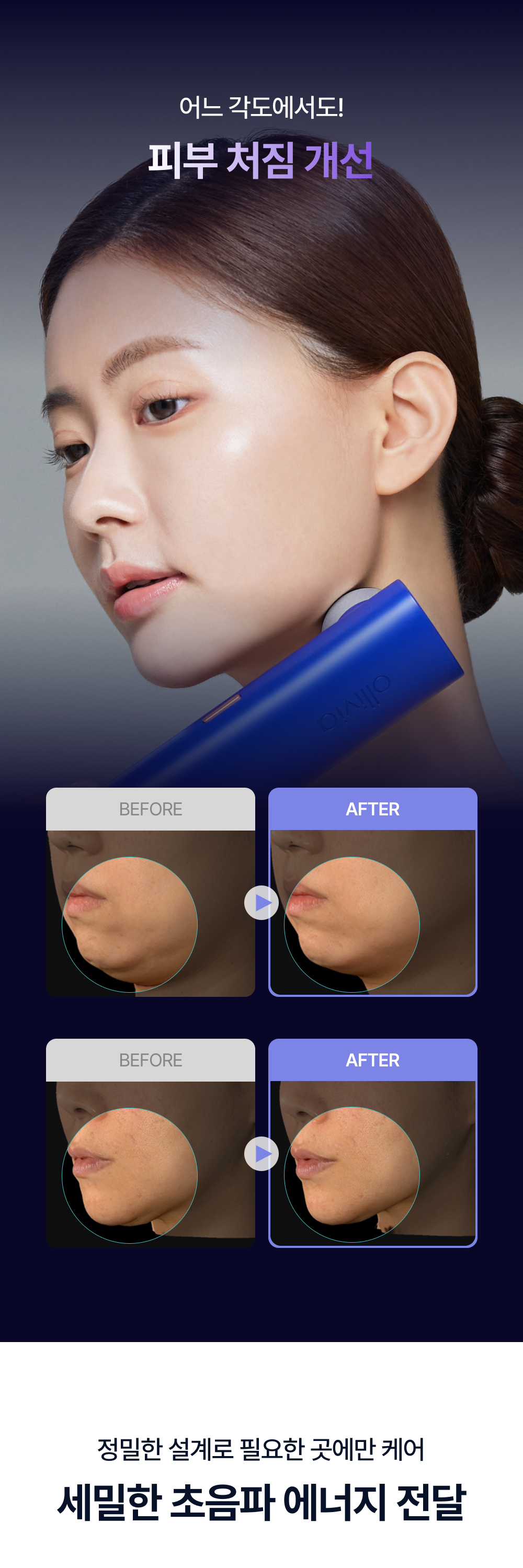 OLLIVIA - The Orlier S1 Beauty Device (Facial Contour & Lifting Care)