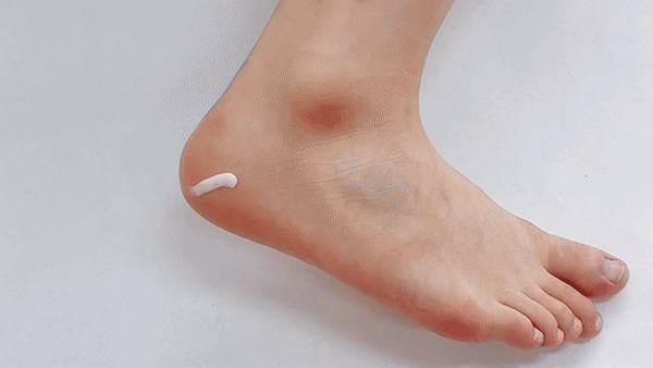 Dermagen - Urea Cream (Skin Softener)