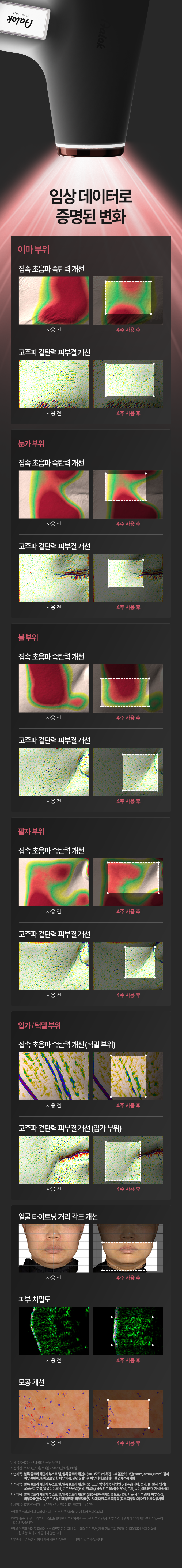 Aalok - ULTRA CHANGE FOCUS – All-in-One Home Beauty Device