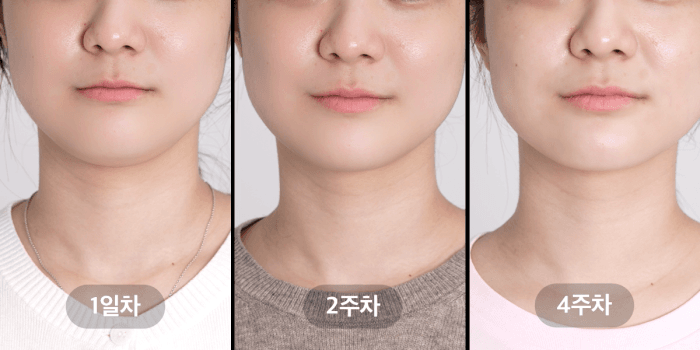 MEDICUBE AGE-R BOOSTER V ROLLER (BEAUTY DEVICE)