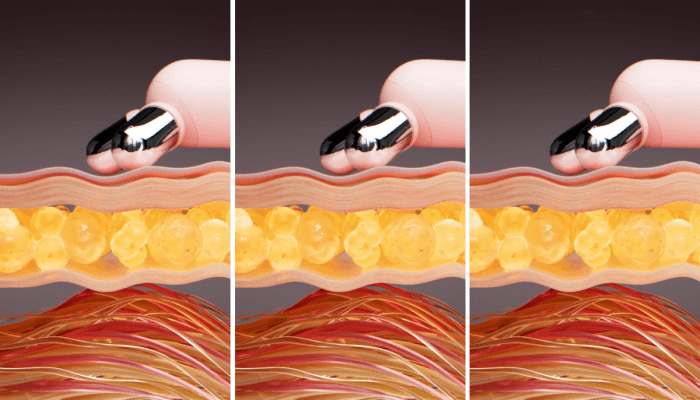 MEDICUBE AGE-R BOOSTER V ROLLER (BEAUTY DEVICE)