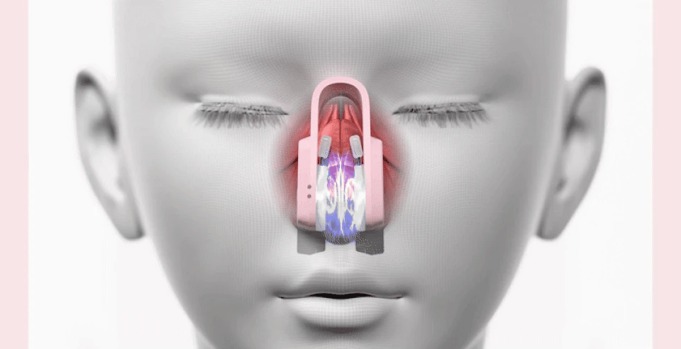 HONBODY - Nose Tune (Beauty Device)