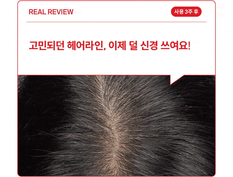 Dr.FORHAIR - Folligen Thickening Scalp Serum 50ml + Pokémon Pouch Key Chain (Pokémon Collaboration)