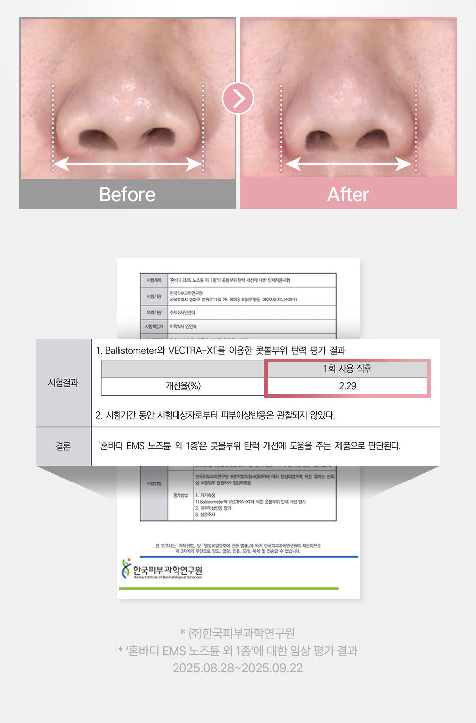 HONBODY - Nose Tune (Beauty Device)