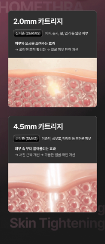 HOMETHERA - Home HIFU Lifting Device (100,000 Shots)