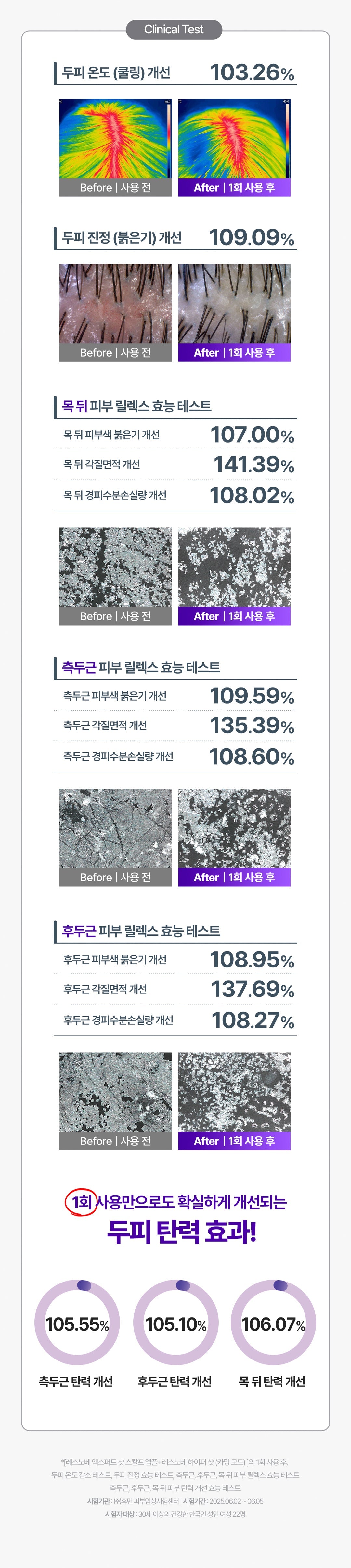 resnovae Hyper Shot (Advanced Scalp & Hair Care Device)