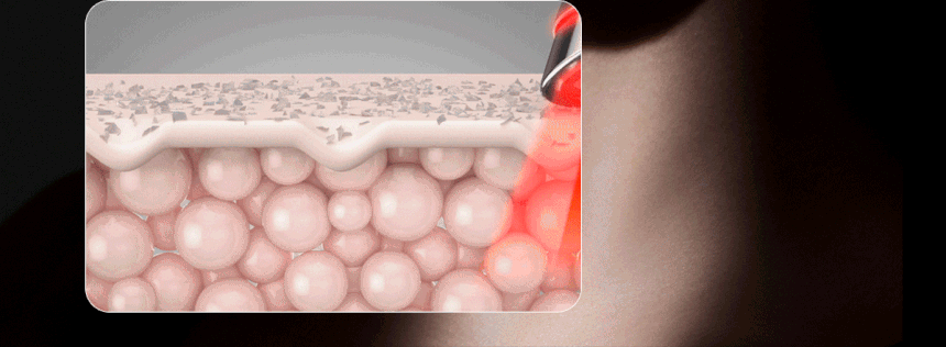 Centellian24 - Madeca Prime Max (Hyper Lifting & Firming Beauty Device)