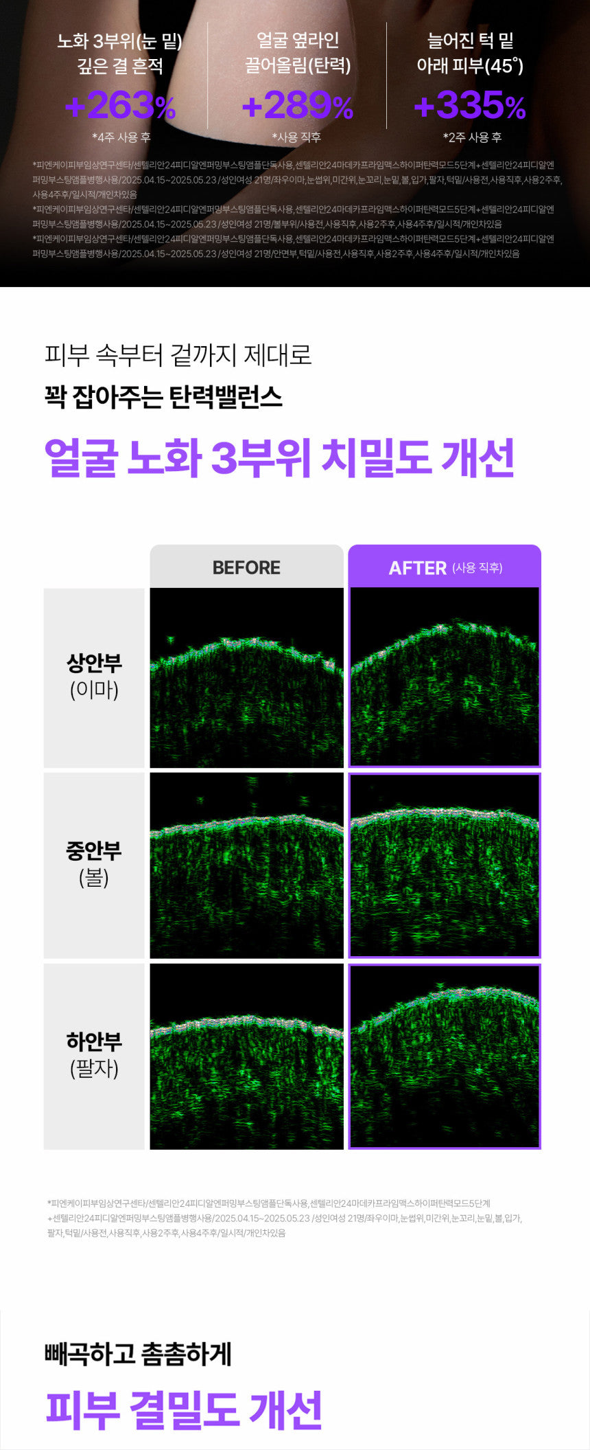 Centellian24 - Madeca Prime Max (Hyper Lifting & Firming Beauty Device)