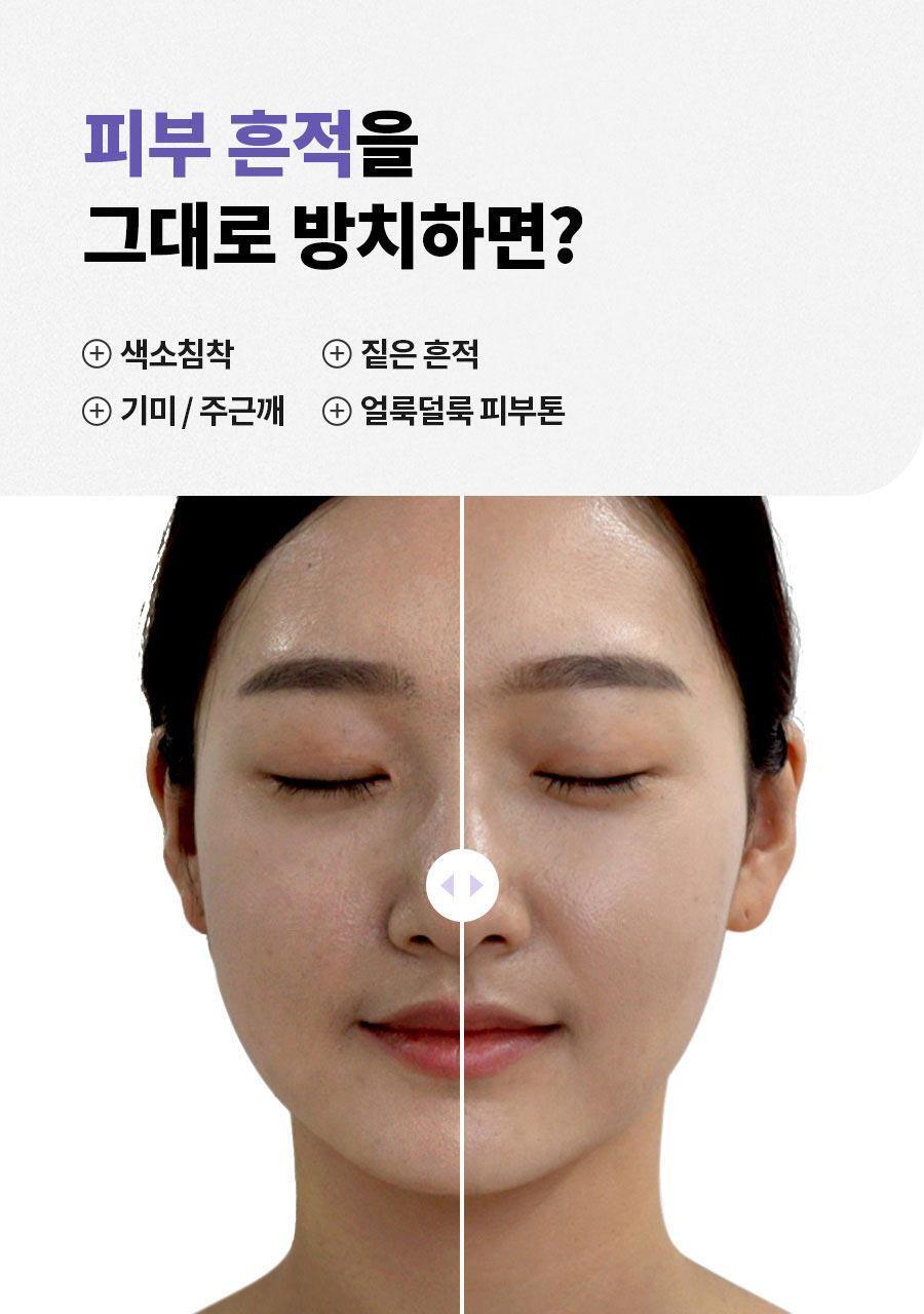 ISNTREE - Onion Newpair Clear Pad (60 + 20 Pads) (NCT JAEMIN Pick)