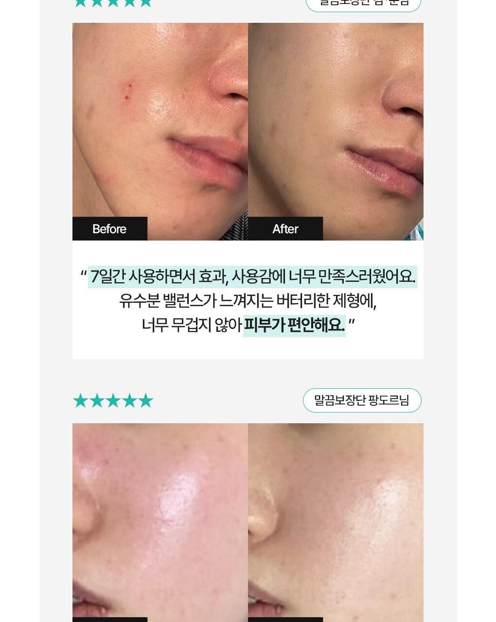 BRINGGREEN X ANKYUNGMANDOO - Zinc TECA Repair Cream 80ml