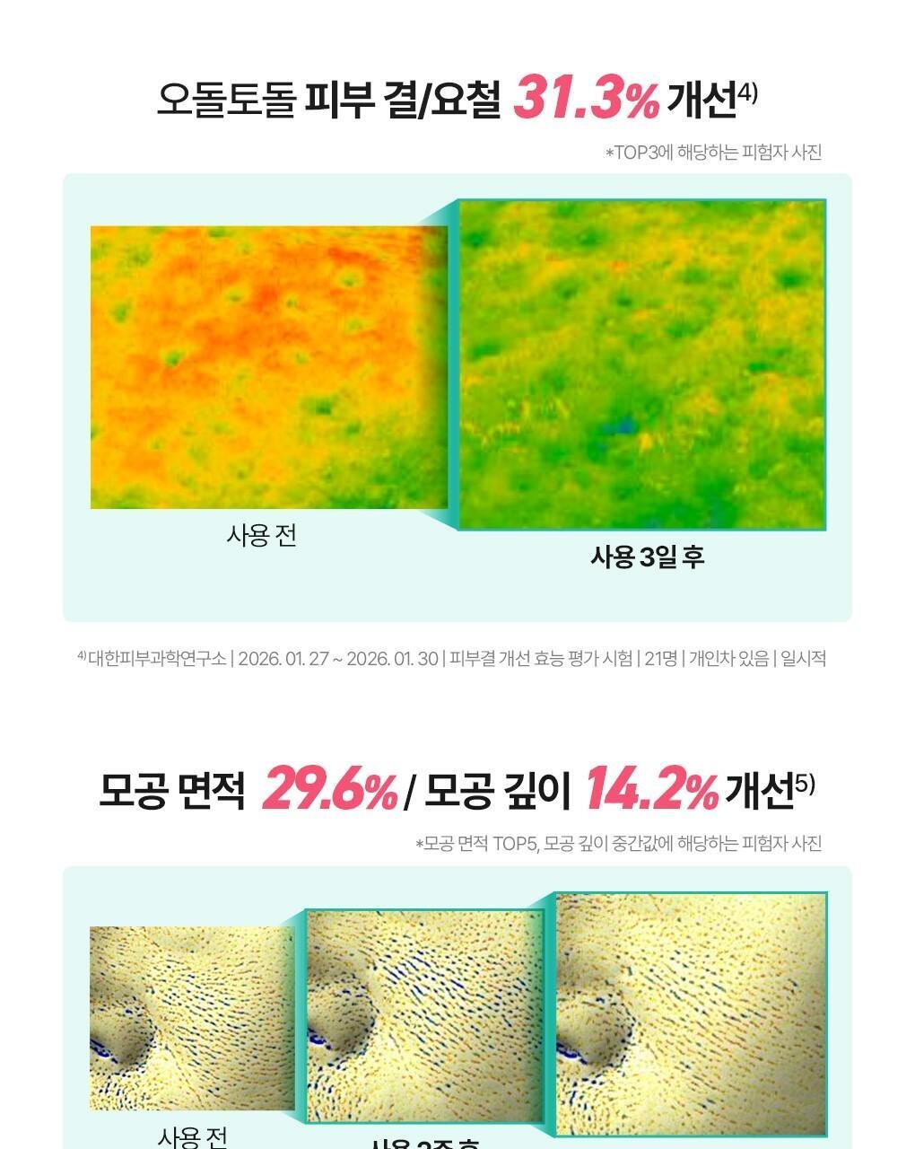 BRINGGREEN X ANKYUNGMANDOO - Zinc TECA Repair Cream 80ml