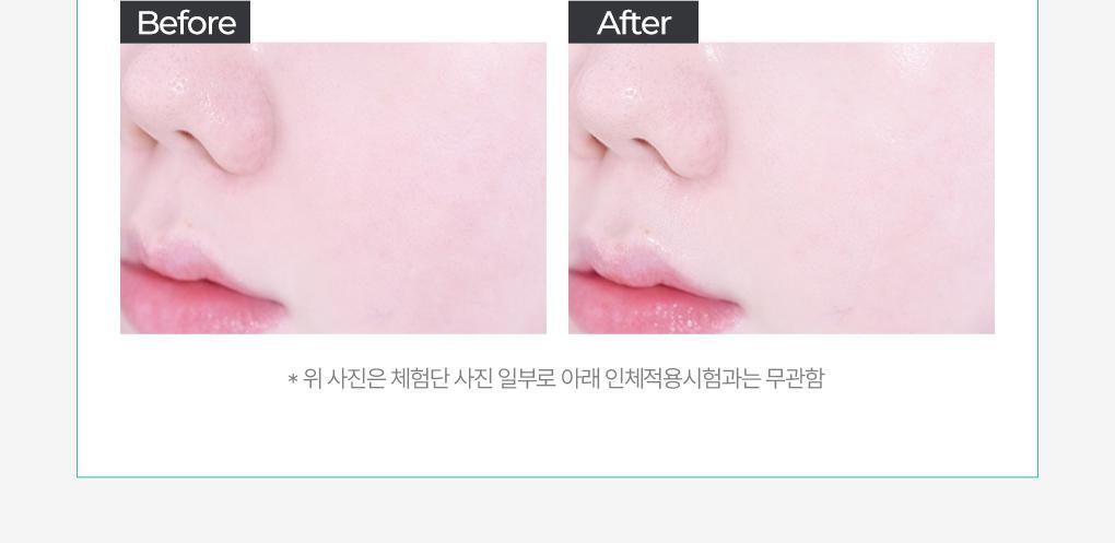 BRINGGREEN - Tea Tree Cica Soothing Toner 500ml (+Serum 3ml)