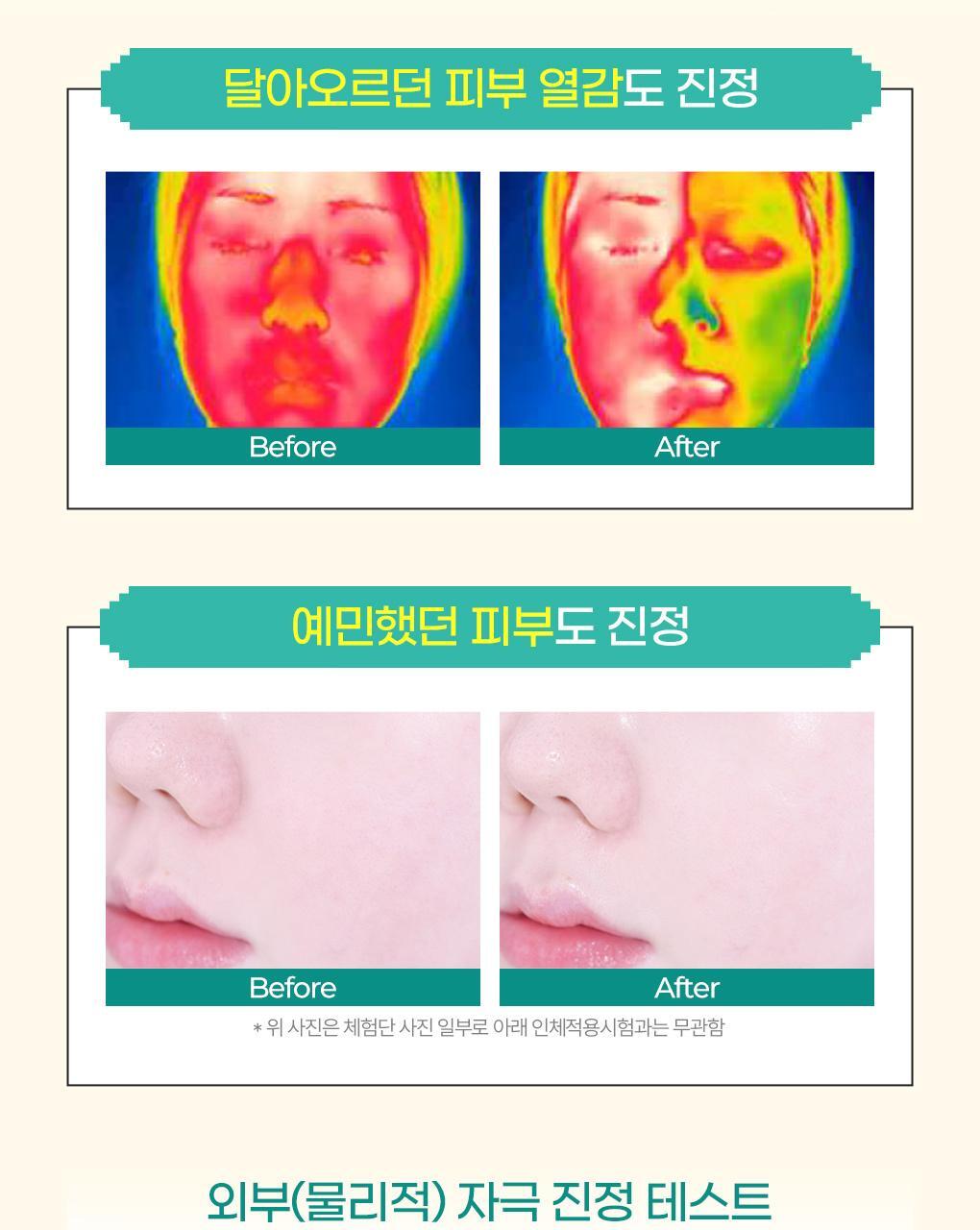 BRINGGREEN X ANKYUNGMANDOO - Tea Tree Cica Soothing Toner (500ml / 250ml)