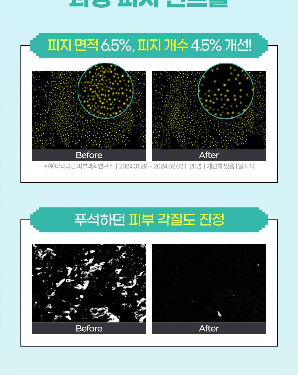 BRINGGREEN X ANKYUNGMANDOO - Tea Tree Cica Soothing Toner (500ml / 250ml)