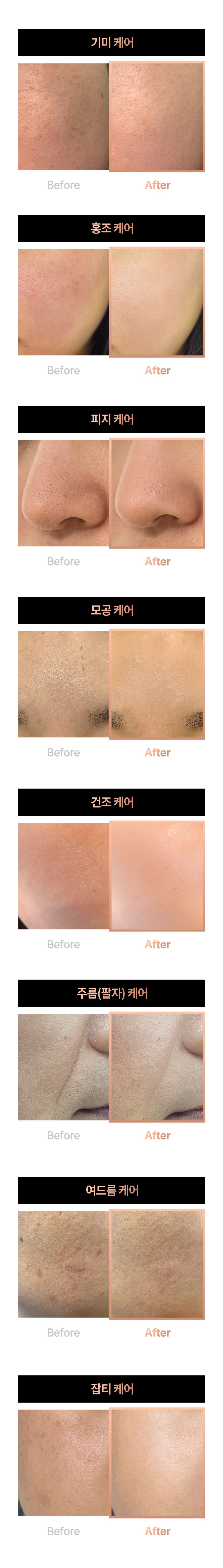 bodyand - Glowthera Beauty Device [New Launch!]