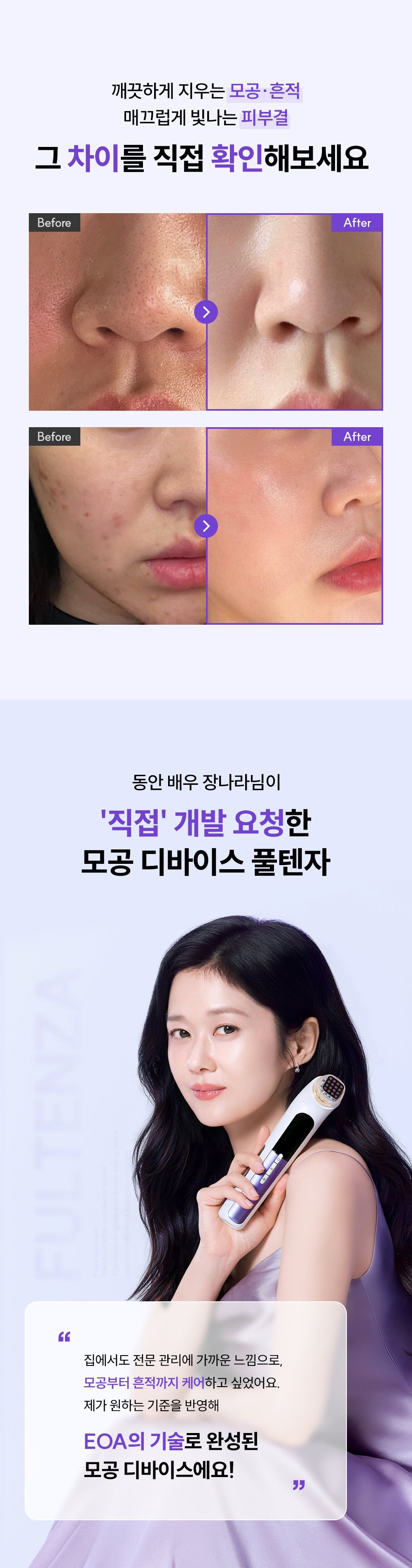 EOA - FULTENZA Premium Lifting Beauty Device [New Launch!]