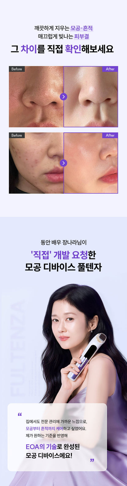 EOA - FULTENZA Premium Lifting Beauty Device [New Launch!]