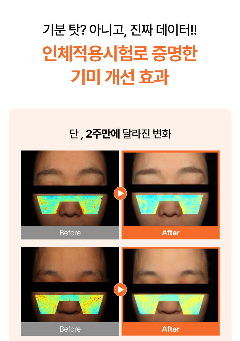 MQNY - Dark Spot Zero 5 in 1 Whitening Cream