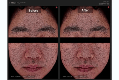 MEDICUBE - Toner Pad (Crayon Shin-chan Edition)