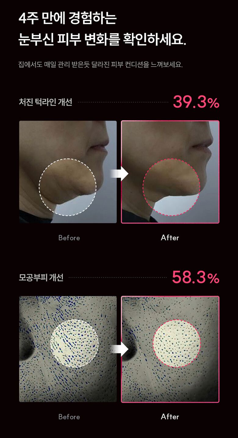 CUCKOO - re:nature Medikin Hi (Beauty Device)