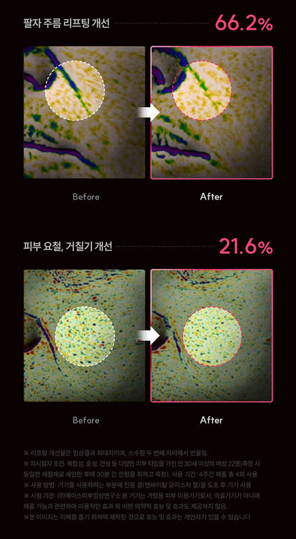 CUCKOO - re:nature Medikin Hi (Beauty Device)