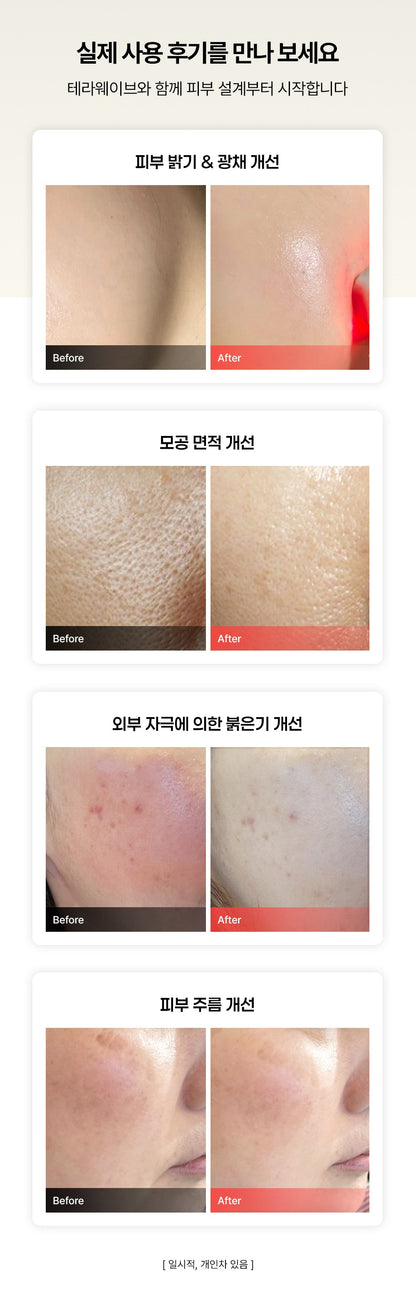 THERAWAVE - Beauty Device (Classic Gift Pack)