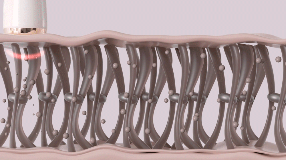 bodyand - Glowthera Beauty Device [New Launch!]