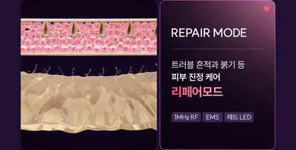 EOA - FULTENZA Premium Lifting Beauty Device [New Launch!]