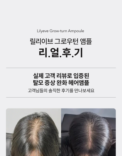 lilyeve Grow Turn Ampoule (Hair Loss Brush Ampoule)