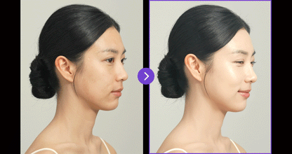 EOA - FULTENZA Premium Lifting Beauty Device [New Launch!]