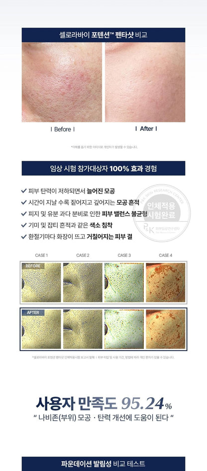 CELORA.BY - POTENSION PENTASHOT (Pore Care & Skin Elasticity Enhancing Beauty Device)