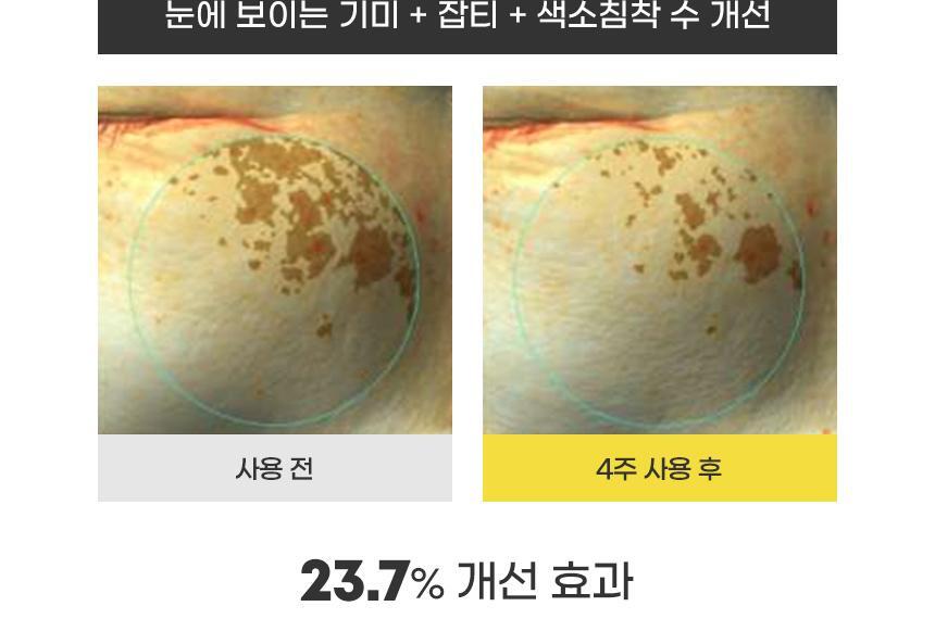 AMPLE:N - Blemi Shot Cream 50ml