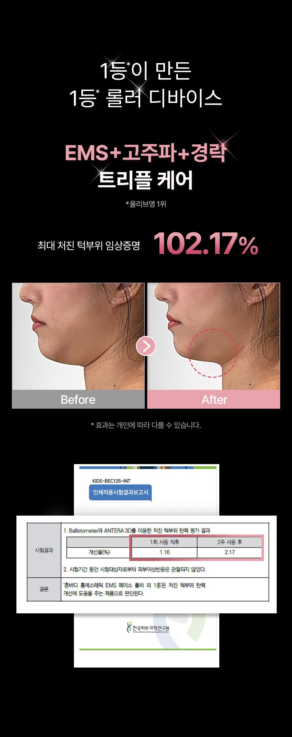 HONBODY - Big Roller Pro EMS Face & Body Massager