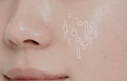 EOA - FULTENZA Premium Lifting Beauty Device [New Launch!]