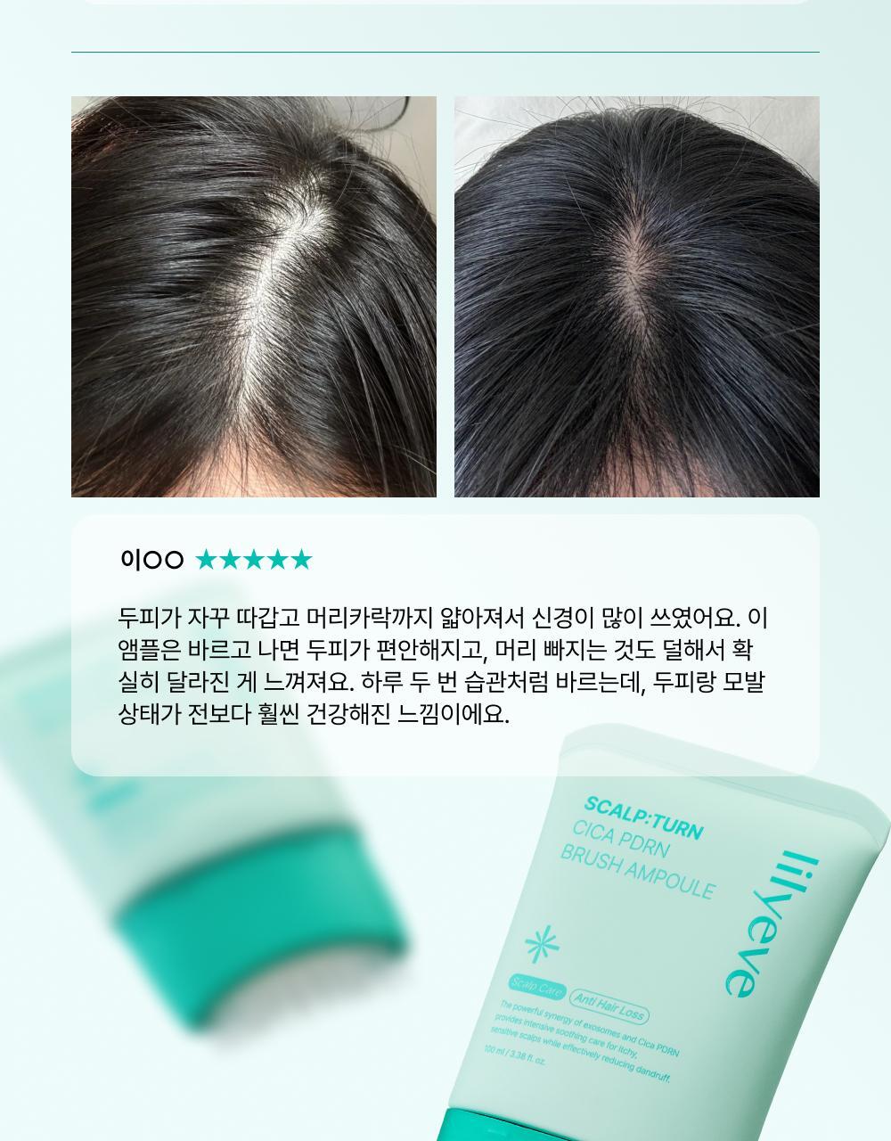 lilyeve - Scalp Turn Cica PDRN Brush Ampoule 100ml + 30ml + Jigglypuff Brush (Pokémon Collaboration)
