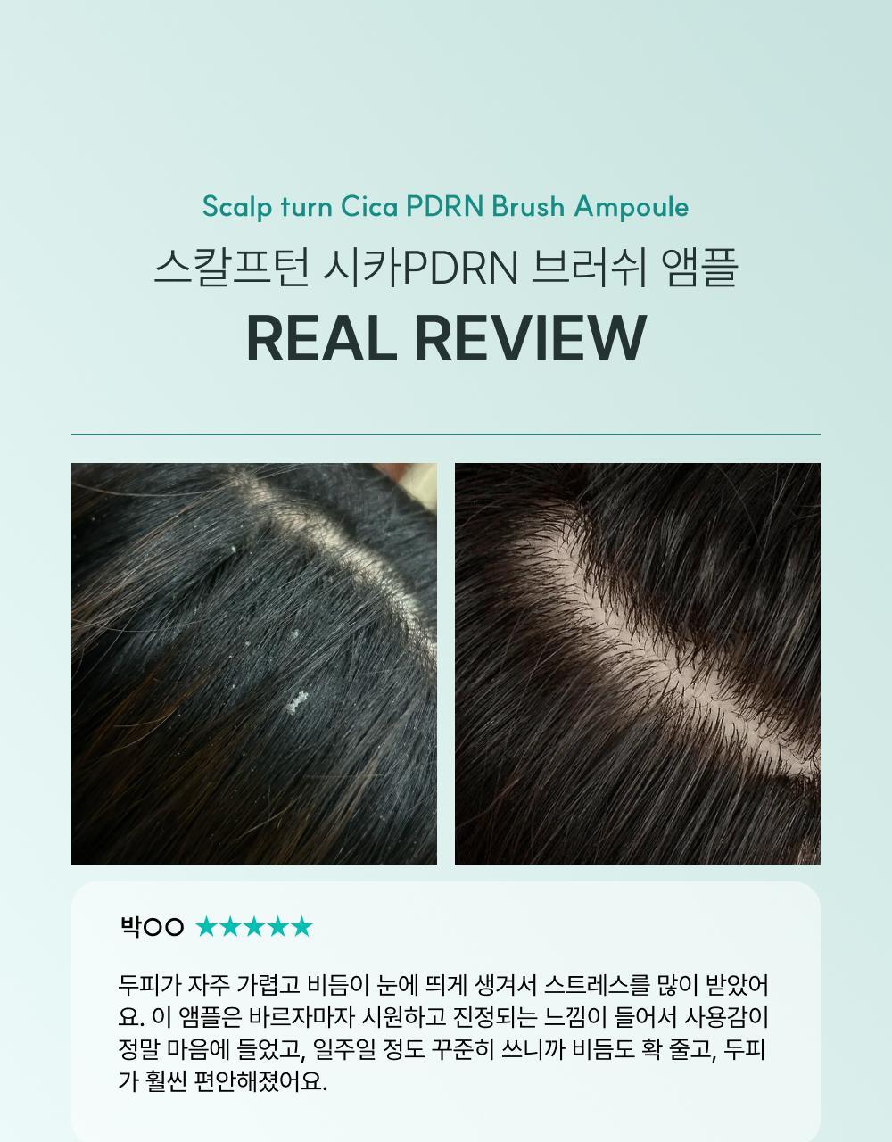 lilyeve - Scalp Turn Cica PDRN Brush Ampoule 100ml + 30ml + Jigglypuff Brush (Pokémon Collaboration)