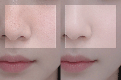 EOA - FULTENZA Premium Lifting Beauty Device [New Launch!]