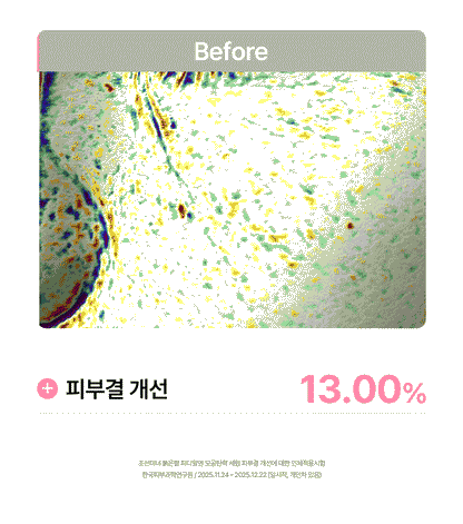 Beauty of Joseon - Red Bean PDRN Pore Tightening & Firming Serum 30ml