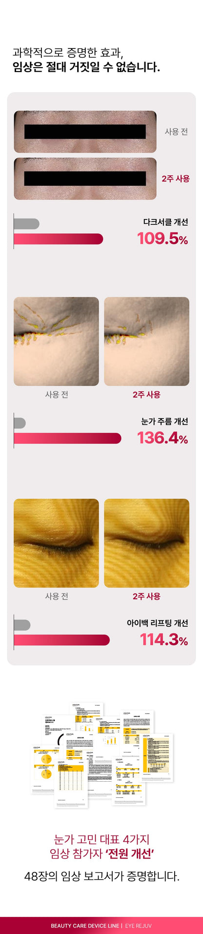 BEAUND - Eye Rejuve (Eye Care Device) [New Launch!]