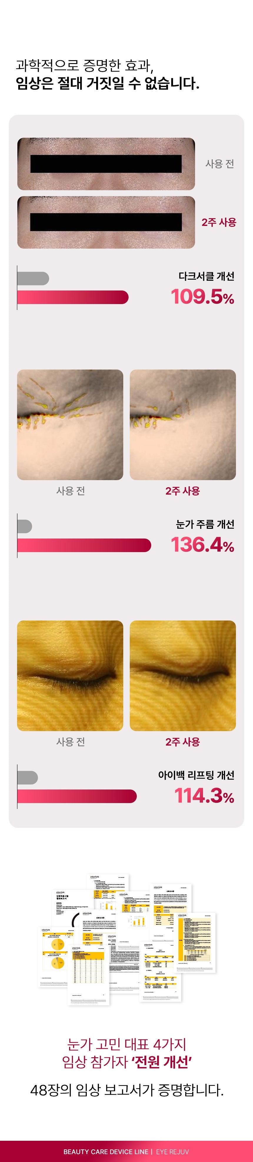 BEAUND - Eye Rejuve (Eye Care Device) [New Launch!]